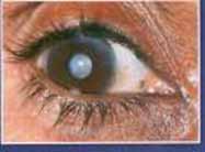 http://www.arrivealive.co.za/images/eye_diseases/eye.jpg