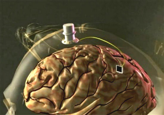 technologie - contrôle de la pensée - cereplex w, une interface neuronale sans fil