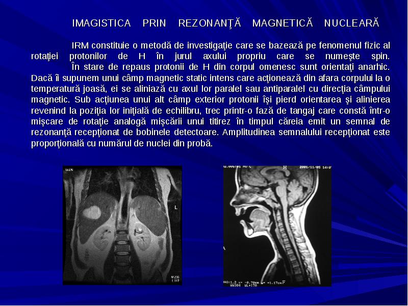 Metode De Explorare Radioimagistică Metode De Explorare Radiologică FĂrĂ SubstanţĂ De Contrast 6700