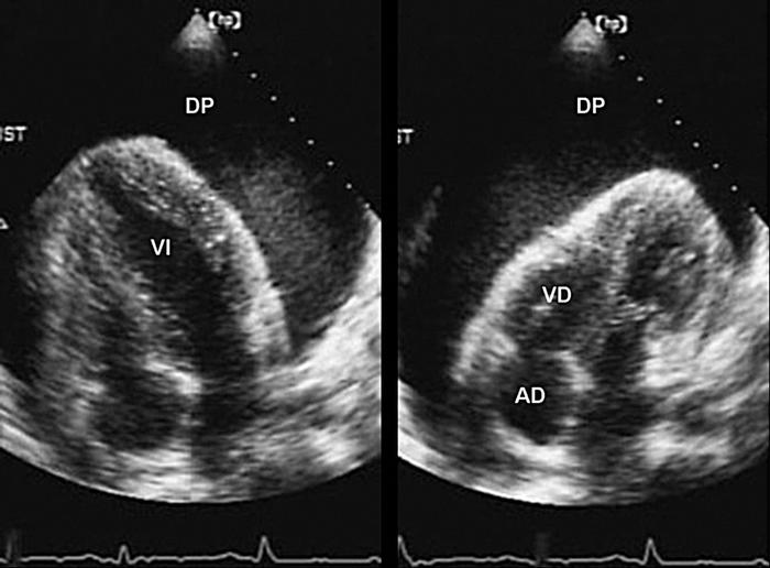 http://www.google.com.co/url?source=imglanding&ct=img&q=http://apuntesmedicos.net/images/ecocardiogramataponamiento.jpg&sa=x&ei=aj4bujf-eir26ggh3icadq&ved=0cakq8wc&usg=afqjcnh6yjgjo4kz7gxozbolvpc12xxdsg