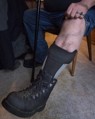 daniel porras, 61, is an army veteran who’s dealing with severe nerve and muscle injuries to his left leg from a motorcycle accident. he has no ankle or achilles tendon on the leg. photo taken in sultan, wash., on dec. 8, 2015.