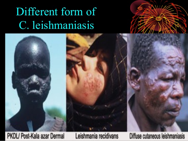 http://image.slidesharecdn.com/leishmaniaparasites-131115112217-phpapp01/95/leishmania-parasites-22-638.jpg?cb=1384515084